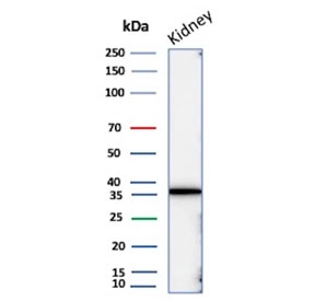 Western blot testing of human kidney tissue lysate with recombinant Napsin A antibody. Expected molecular weight: 38-45 kDa.
