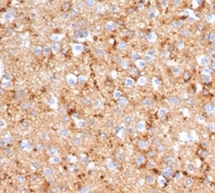 IHC staining of FFPE human brain tissue with recombinant SYP antibody (clone rSYP/6856). HIER: boil tissue sections in pH 9 10mM Tris with 1mM EDTA for 20 min and allow to cool before testing.