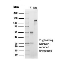 SDS-PAGE analysis of purified, BSA-free recombinant CD33 antibody (clone SIGLEC3/7046R) as confirmation of integrity and purity.