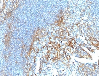 IHC staining of FFPE human tonsil tissue with ICAM-1 antibody (clone ICAM1/6917). HIER: boil tissue sections in pH 9 10mM Tris with 1mM EDTA for 20 min and allow to cool before testing.