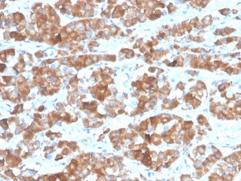 IHC staining of FFPE human pituitary tissue with recombinant Luteinizing Hormone beta antibody (clone LHb/1612R). HIER: boil tissue sections in pH 9 10mM Tris with 1mM EDTA for 20 min and allow to cool before testing.
