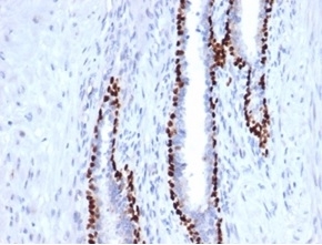 IHC staining of FFPE human prostate tissue with recombinant deltaNp63 antibody (clone P40/4396R). HIER: boil tissue sections in pH 9 10mM Tris with 1mM EDTA for 20 min and allow to cool before testing.