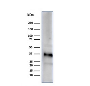 Western blot testing of human testis tissue lysate using Apolipoprotein J antibody (clone CLU/4729). Predicted molecular weight: 75-80 kDa (heterodimer precursor), 36-39 kDa (alpha subunit), 34-36 kDa (beta subunit).