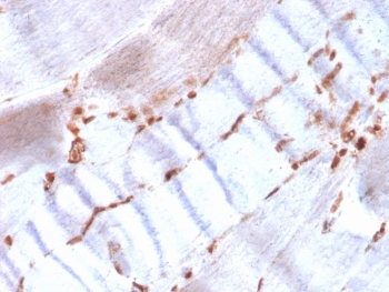 IHC staining of FFPE human skeletal muscle with recombinant Actin antibody (clone ACTA2/1614R). HIER: boil tissue sections in pH 9 10mM Tris with 1mM EDTA for 20 min and allow to cool before testing.