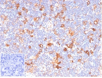 IHC staining of FFPE human lymph node tissue with recombinant CD86 antibody (clone C86/6500R). Negative control inset: PBS used instead of primary antibody to control for secondary Ab binding. HIER: boil tissue sections in pH 9 10mM Tris with 1mM EDTA for 20 min and allow to cool before testing.