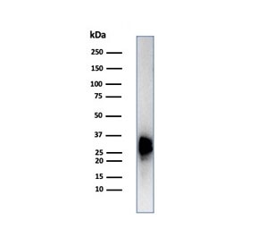 Western blot testing of human testis tissue lysate using Calbindin 2 antibody (clone CALB2/7029R). Predicted molecular weight ~29 kDa.