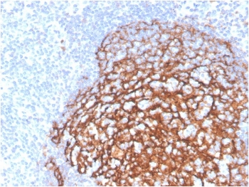IHC staining of FFPE human tonsil tissue with recombinant CD21 antibody (clone CR2/3990R). HIER: boil tissue sections in pH 9 10mM Tris with 1mM EDTA for 20 min and allow to cool before testing.