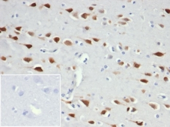 IHC staining of FFPE human brain tissue with recombinant NeuN antibody (clone NeuN/6694R). Negative control inset: PBS used instead of primary antibody to control for secondary Ab binding.
