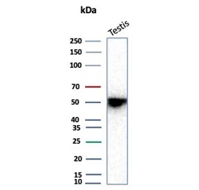 Western blot testing of human testis tissue with recombinant INHA antibody (clone rINHA/6919).