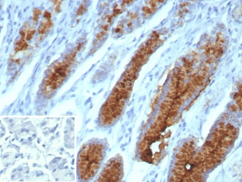 IHC staining of FFPE human stomach tissue with recombinant Mucin 5AC antibody (clone MUC5AC/7066R). HIER: boil tissue sections in pH 9 10mM Tris with 1mM EDTA for 20 min and allow to cool before testing.