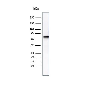 Western blot testing of human heart tissue lysate using Phosphoglucomutase 5 antibody (clone PGM5/3552). Predicted molecular weight ~62 kDa.