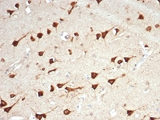 IHC staining of FFPE human brain tissue with LPLUNC1 antibody (clone LPLUNC1/7059R). HIER: boil tissue sections in pH 9 10mM Tris with 1mM EDTA for 20 min and allow to cool before testing.