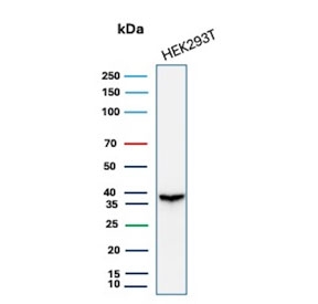 Western blot testing of human 293T cell lysate with recombinant Aldose reductase 1B1 antibody (clone rAKR1B1/7296). Predicted molecular weight ~36 kDa.